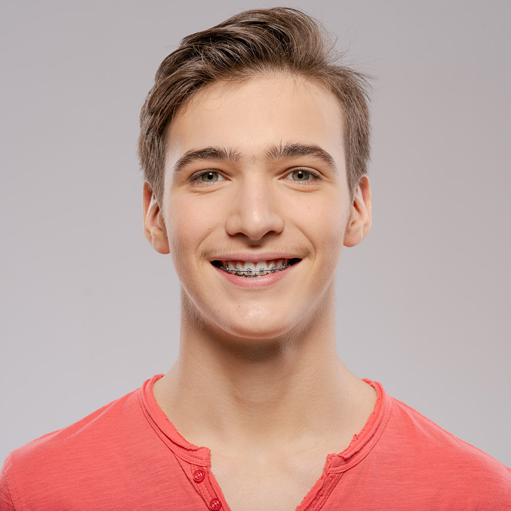 Teenage boy in red shirt smiling with metal braces after orthodontic treatment
