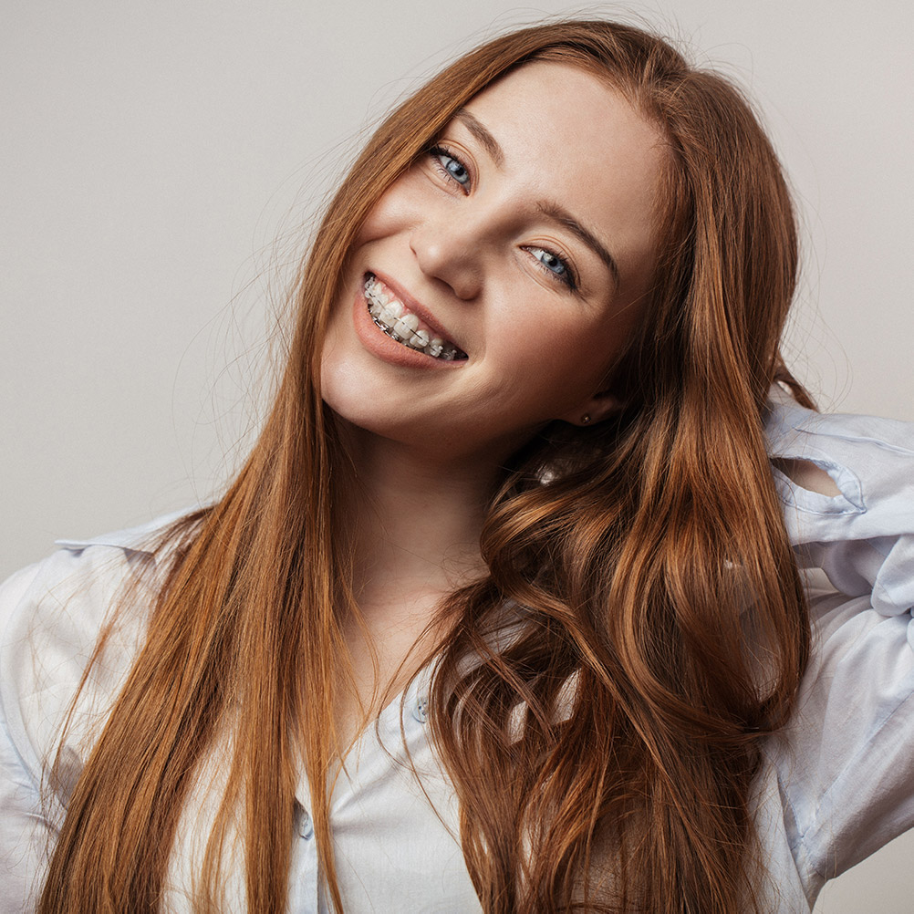 Smiling red-haired woman with braces showing esthetic orthodontics results