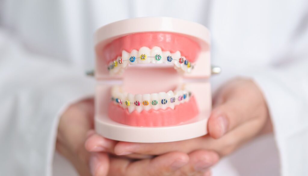 Orthodontist holding a dental model of upper and lower teeth with colorful braces to explain treatment and care.