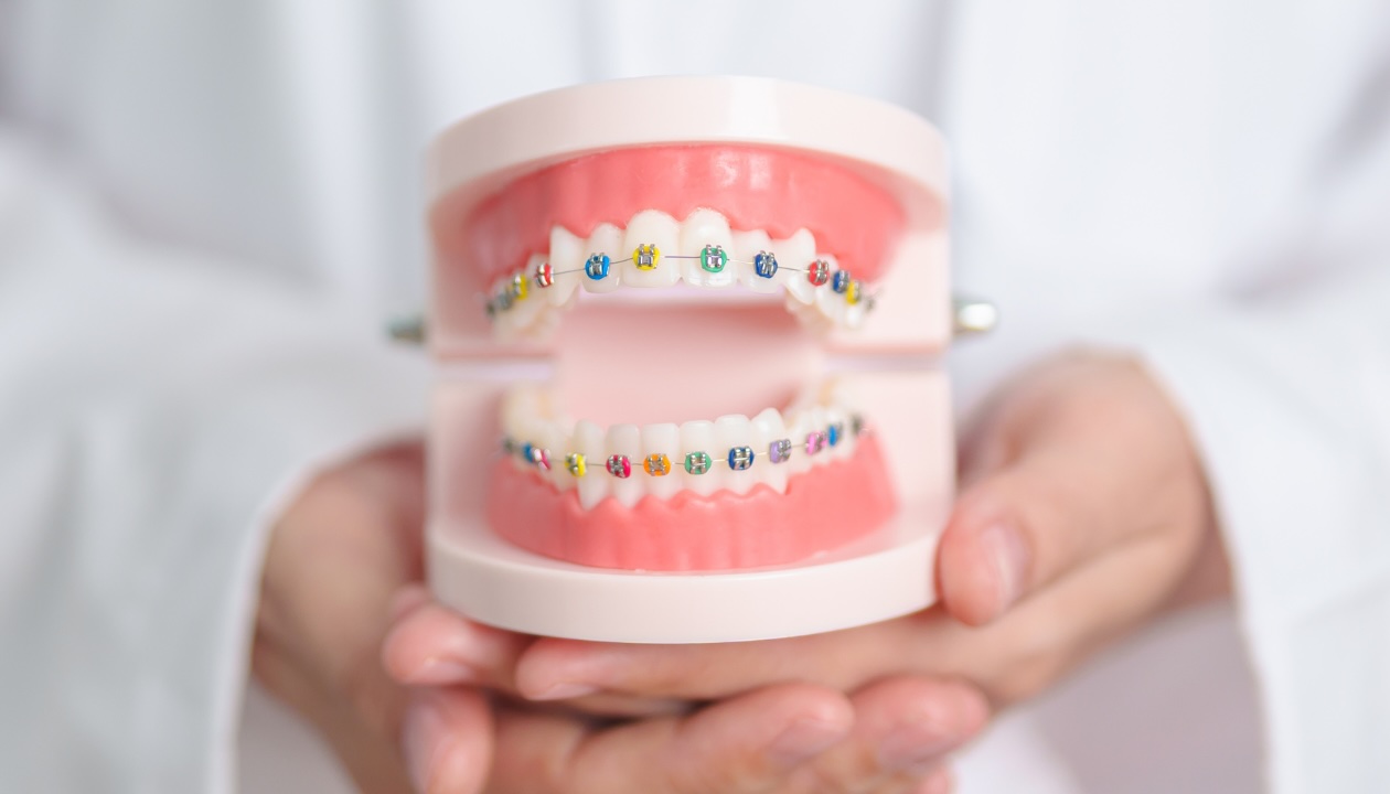 Orthodontist holding a dental model of upper and lower teeth with colorful braces to explain treatment and care.